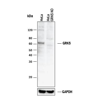 Knockout Validated GRK5 Antibody [Unconjugated]