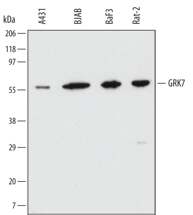 Western Blot GRK7 Antibody (496831)