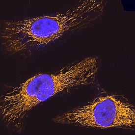 GRP75/HSPA9B was detected in immersion fixed HeLa human cervical epithelial carcinoma cell line using Goat Anti-Human/Mouse/Rat GRP75/HSPA9B Antigen Affinity-purified Polyclonal Antibody (Catalog # AF3584) at 5 µg/mL for 3 hours at room temperature. Cells were stained using the NorthernLights™ 557-conjugated Anti-Goat IgG Secondary Antibody (yellow; Catalog # NL001) and counterstained with DAPI (blue). Specific staining was localized to mitochondria. View our protocol for Fluorescent ICC Staining of Cells on Coverslips.