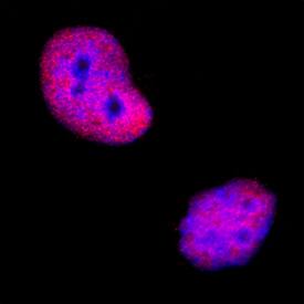 GR/NR3C1 was detected in immersion fixed HeLa human cervical epithelial carcinoma cell line using Mouse Anti-Human/Rat GR/NR3C1 Monoclonal Antibody (Catalog # MAB10144) at 8 µg/mL for 3 hours at room temperature. Cells were stained using the NorthernLights™ 557-conjugated Anti-Mouse IgG Secondary Antibody (red; Catalog # NL007) and counterstained with DAPI (blue). Specific staining was localized to nuclei. View our protocol for Fluorescent ICC Staining of Cells on Coverslips.