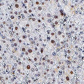 GR/NR3C1 was detected in immersion fixed paraffin-embedded sections of human liver using Mouse Anti-Human/Rat GR/NR3C1 Monoclonal Antibody (Catalog # MAB10144) at 5 µg/mL for 1 hour at room temperature followed by incubation with the Anti-Mouse IgG VisUCyte™ HRP Polymer Antibody (Catalog # VC001). Before incubation with the primary antibody, tissue was subjected to heat-induced epitope retrieval using Antigen Retrieval Reagent-Basic (Catalog # CTS013). Tissue was stained using DAB (brown) and counterstained with hematoxylin (blue). Specific staining was localized to nuclei. View our protocol for IHC Staining with VisUCyte HRP Polymer Detection Reagents.