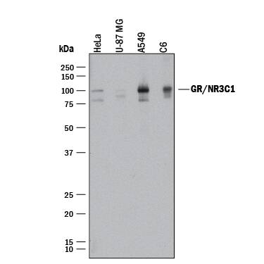 Western blot shows lysates of HeLa human cervical epithelial carcinoma cell line, U-87 MG human glioblastoma/astrocytoma cell line, A549 human lung carcinoma cell line, and C6 rat glioma cell line. PVDF membrane was probed with 2 µg/mL of Mouse Anti-Human/Rat GR/NR3C1 Monoclonal Antibody (Catalog # MAB10144) followed by HRP-conjugated Anti-Mouse IgG Secondary Antibody (Catalog # HAF018). A specific band was detected for GR/NR3C1 at approximately 85 kDa (as indicated). This experiment was conducted under reducing conditions and using Immunoblot Buffer Group 1.