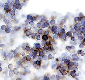 <b>Biological Strategies Validation. </b>GSK‑3a was detected in immersion fixed paraffin-embedded sections of human thymus using 5 &micro;g/mL Human/Mouse/Rat Phospho-GSK‑3a (S21) Antigen Affinity-purified Polyclonal Antibody (Catalog # AF4125) overnight at 4 &deg;C. Before incubation with the primary antibody tissue was subjected to heat-induced epitope retrieval using Antigen Retrieval Reagent-Basic (Catalog # CTS013). Tissue was stained with the Anti-Rabbit HRP-DAB Cell & Tissue Staining Kit (brown; Catalog # CTS005) and counterstained with hematoxylin (blue). View our protocol for Chromogenic IHC Staining of Paraffin-embedded Tissue Sections.