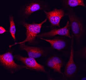 Immunocytochemistry GSK-3 alpha/beta Antibody [Unconjugated]