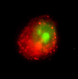 GSK‑3 beta  was detected in immersion fixed MCF-7 human breast cancer cell line using 10 &micro;g/mL Human GSK‑3 beta  Monoclonal Antibody (Catalog # MAB25061) for 3 hours at room temperature. Cells were stained (red) and counterstained (green). View our protocol for Fluorescent ICC Staining of Cells on Coverslips.