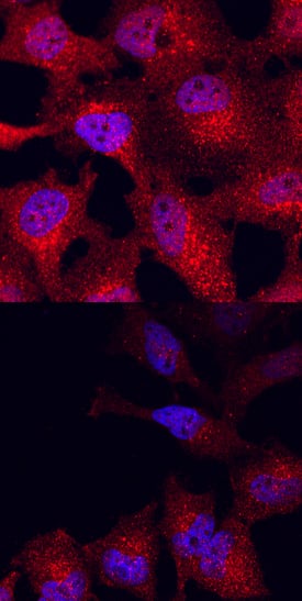 <b>Biological Strategies Validation. </b>GSK-3 beta  phosphorylated at S9 was detected in immersion fixed HeLa human cervical epithelial carcinoma cells, unstimulated (lower panel) or stimulated (upper panel) with PMA, using Mouse Anti-Human Phospho-GSK-3 beta  (S9) Monoclonal Antibody (Catalog # MAB25062) at 10 µg/mL for 3 hours at room temperature. Cells were stained using the NorthernLights™ 557-conjugated Anti-Mouse IgG Secondary Antibody (red; Catalog # NL007) and counterstained with DAPI (blue). Specific staining was localized to cytoplasm. View our protocol for Fluorescent ICC Staining of Cells on Coverslips.