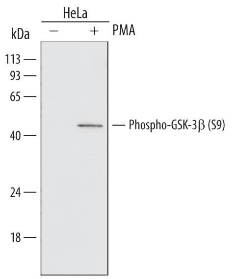 Western blot shows lysates of HeLa human cervical epithelial carcinoma cell line untreated (-) or treated (+) with 200 nM PMA for 20 minutes. PVDF Membrane was probed with 1 µg/mL of Human Phospho-GSK-3 beta  (S9) Monoclonal Antibody (Catalog # MAB25062) followed by HRP-conjugated Anti-Mouse IgG Secondary Antibody (Catalog # HAF007). A specific band was detected for Phospho-GSK-3 beta  (S9) at approximately 46 kDa (as indicated). This experiment was conducted under reducing conditions and using Immunoblot Buffer Group 1.