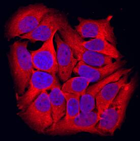 GSK-3a was detected in immersion fixed MCF-7 human breast cancer cell line using Mouse Anti-Human GSK-3a Monoclonal Antibody (Catalog # MAB2986) at 10 µg/mL for 3 hours at room temperature. Cells were stained using the NorthernLights™ 557-conjugated Anti-Mouse IgG Secondary Antibody (red; Catalog # NL007) and counterstained with DAPI (blue). Specific staining was localized to cytoplasm. View our protocol for Fluorescent ICC Staining of Cells on Coverslips.