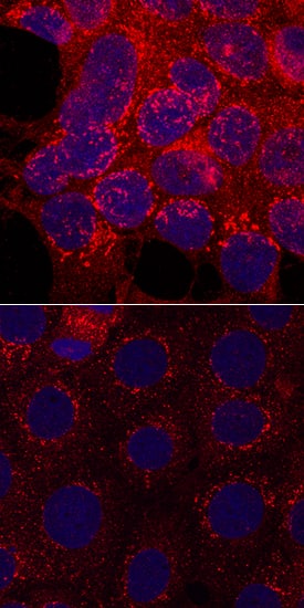 <b>Biological Strategies Validation. </b>GSK-3 beta  phosphorylated at S9 was detected in immersion fixed MCF-7 human breast cancer cell line untreated (lower panel) or treated with 100 ng/mL Recombinant Human IGF-I (Catalog # 291-G1; upper panel) using Rabbit Anti-Human Phospho-GSK-3 beta  Monoclonal Antibody (Catalog # MAB8934) at a 1 µg/mL for 3 hours at room temperature. Cells were stained using the NorthernLights™ 557-conjugated Anti-Rabbit IgG Secondary Antibody (red; Catalog # NL004) and counterstained with DAPI (blue). Specific staining was localized to cytoplasm. View our protocol for Fluorescent ICC Staining of Cells on Coverslips.