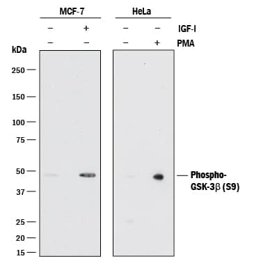 Western blot shows lysates of untreated (-) or MCF-7 human breast cancer cell line treated (+) with 100 ng/ml Recombinant Human IGF-I (Catalog # 291-G1) for 60 minutes and HeLa human cervical epithelial carcinoma cell line treated (+) with 200 nM PMA for 20 minutes. PVDF membrane was probed with 0.5 µg/mL of Rabbit Anti-Human Phospho-GSK-3 beta  Monoclonal Antibody (Catalog # MAB8934) followed by HRP-conjugated Anti-Rabbit IgG Secondary Antibody (Catalog # HAF008). A specific band was detected for Phospho-GSK-3 beta  (S9) at approximately 48 kDa (as indicated). This experiment was conducted under reducing conditions and using Immunoblot Buffer Group 1.