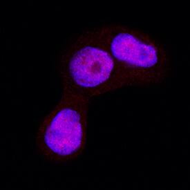 GSK-3a/ beta  was detected in immersion fixed HT-29 human colon adenocarcinoma cell line using Mouse Anti-Human GSK-3a/ beta  Monoclonal Antibody (Catalog # MAB25063) at 3 µg/mL for 3 hours at room temperature. Cells were stained using the NorthernLights™ 557-conjugated Anti-Mouse IgG Secondary Antibody (red; Catalog # NL007) and counterstained with DAPI (blue). Specific staining was localized to nuclei and cytoplasm. View our protocol for Fluorescent ICC Staining of Cells on Coverslips.