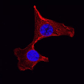 GSK-3 beta  was detected in immersion fixed NIH-3T3 mouse embryonic fibroblast cell line using Rat Anti-Human/Mouse/Rat GSK-3 beta  Monoclonal Antibody (Catalog # MAB2506) at 3 µg/mL for 3 hours at room temperature. Cells were stained using the NorthernLights™ 557-conjugated Anti-Rat IgG Secondary Antibody (red; Catalog # NL013) and counterstained with DAPI (blue). Specific staining was localized to nuclei and cytoplasm. View our protocol for Fluorescent ICC Staining of Cells on Coverslips.