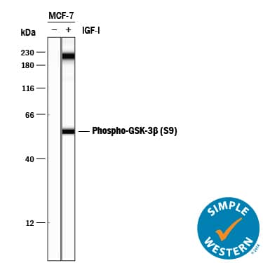 <b>Biological Strategies Validation. </b>Simple Western lane view shows lysates of MCF-7 human breast cancer cell line untreated (-) or treated (+) with 100 ng/mL Recombinant Human IGF-I (Catalog # 291-G1) for 60 minutes, loaded at 0.2 mg/mL. A specific band was detected for Phospho-GSK-3 beta  (S9) at approximately 56 kDa (as indicated) using 5 µg/mL of Rabbit Anti-Human Phospho-GSK-3 beta  Monoclonal Antibody (Catalog # MAB8934) . This experiment was conducted under reducing conditions and using the 12-230 kDa separation system. Non-specific interaction with the 230 kDa Simple Western standard may be seen with this antibody.
