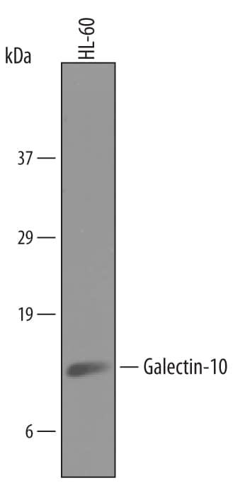 Western Blot Galectin-10 Antibody [Unconjugated]