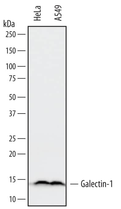 Western Blot Galectin-1 Antibody [Unconjugated]