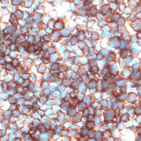 Galectin‑1 was detected in perfusion fixed frozen sections of mouse thymus using Goat Anti-Mouse Galectin‑1 Antigen Affinity-purified Polyclonal Antibody (Catalog # AF1245) at 5 &micro;g/mL overnight at 4 &deg;C. Tissue was stained using the Anti-Goat HRP-DAB Cell & Tissue Staining Kit (brown; Catalog # CTS008) and counterstained with hematoxylin (blue). Specific labeling was localized to the cytoplasm of lymphocytes. View our protocol for Chromogenic IHC Staining of Frozen Tissue Sections.