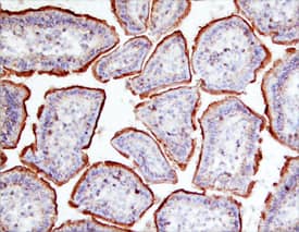 Immunohistochemistry Galectin-2 Antibody