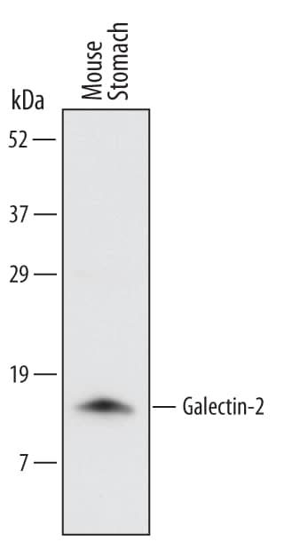 Western Blot Galectin-2 Antibody