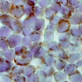 Galectin-7 was detected in perfusion fixed frozen sections of mouse thymus using Rat Anti-Mouse Galectin-7 Monoclonal Antibody (Catalog # MAB1304) at 25 µg/mL overnight at 4 °C. Tissue was stained using the Anti-Rat HRP-DAB Cell & Tissue Staining Kit (brown; Catalog # CTS017) and counterstained with hematoxylin (blue). Specific labeling was localized to the cytoplasm of lymphocytes. View our protocol for Chromogenic IHC Staining of Frozen Tissue Sections.