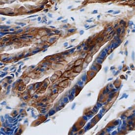 Galectin-9 was detected in perfusion fixed frozen sections of mouse colon using Rat Anti-Mouse Galectin-9 Monoclonal Antibody (Catalog # MAB3535) at 25 µg/mL overnight at 4 °C. Tissue was stained using the Anti-Rat HRP-DAB Cell & Tissue Staining Kit (brown; Catalog # CTS017) and counterstained with hematoxylin (blue). Specific staining was localized to plasma membranes and cytoplasm of epithelial cells. View our protocol for Chromogenic IHC Staining of Frozen Tissue Sections.