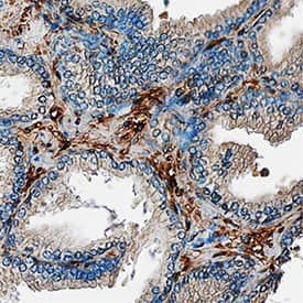Galectin-1 was detected in immersion fixed paraffin-embedded sections of human prostate using Mouse Anti-Human Galectin-1 Monoclonal Antibody (Catalog # MAB1152) at 15 µg/mL overnight at 4 °C. Tissue was stained using the Anti-Mouse HRP-DAB Cell & Tissue Staining Kit (brown; Catalog # CTS002) and counterstained with hematoxylin (blue). Specific staining was localized to stromal cells. View our protocol for Chromogenic IHC Staining of Paraffin-embedded Tissue Sections.