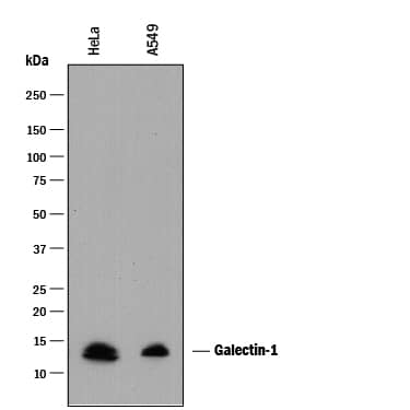 Western blot shows lysates of HeLa human cervical epithelial carcinoma cell line and A549 human lung carcinoma cell line. PVDF membrane was probed with 2 µg/mL of Mouse Anti-Human Galectin-1 Monoclonal Antibody (Catalog # MAB1152) followed by HRP-conjugated Anti-Mouse IgG Secondary Antibody (Catalog # HAF018). A specific band was detected for Galectin-1 at approximately 14 kDa (as indicated). This experiment was conducted under reducing conditions and using Immunoblot Buffer Group 1.
