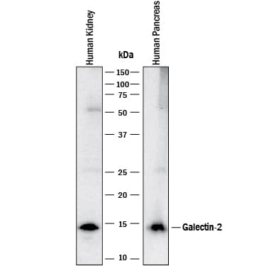 Western blot shows lysates of human kidney tissue and human pancreas tissue. PVDF membrane was probed with 1 µg/mL of Rabbit Anti-Human Galectin-2 Monoclonal Antibody (Catalog # MAB1153) followed by HRP-conjugated Anti-Rabbit IgG Secondary Antibody (Catalog # HAF008). A specific band was detected for Galectin-2 at approximately 14 kDa (as indicated). This experiment was conducted under reducing conditions and using Immunoblot Buffer Group 1.