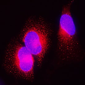 Galectin-3BP/MAC-2BP was detected in immersion fixed HeLa human cervical epithelial carcinoma cell line using Goat Anti-Human Galectin-3BP/MAC-2BP Antigen Affinity-purified Polyclonal Antibody (Catalog # AF2226) at 1.7 µg/mL for 3 hours at room temperature. Cells were stained using the NorthernLights™ 557-conjugated Anti-Goat IgG Secondary Antibody (red;NL001) and counterstained with DAPI (blue). Specific staining was localized to cytoplasm. View our protocol for Fluorescent ICC Staining of Cells on Coverslips.