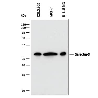 Western blot shows lysates of COLO 205 human colorectal adenocarcinoma cell line, MCF-7 human breast cancer cell line, and U-118-MG human glioblastoma/astrocytoma cell line. PVDF membrane was probed with 0.1 µg/mL of Goat Anti-Human Galectin-3 Antigen Affinity-purified Polyclonal Antibody (Catalog # AF1154) followed by HRP-conjugated Anti-Goat IgG Secondary Antibody (HAF017). A specific band was detected for Galectin-3 at approximately 28 kDa (as indicated). This experiment was conducted under reducing conditions and using Immunoblot Buffer Group 1.