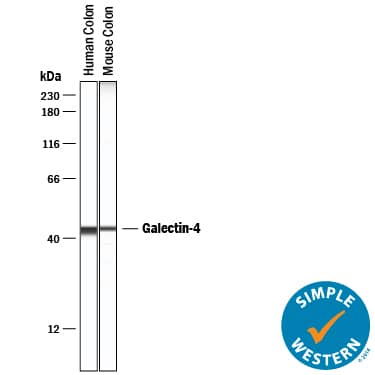 Simple Western Galectin-4 Antibody [Unconjugated]