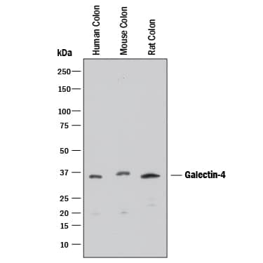 Western Blot Galectin-4 Antibody [Unconjugated]