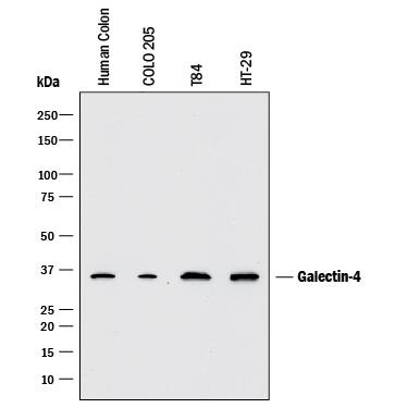 Western blot shows lysates of human colon tissue, COLO 205 human colorectal adenocarcinoma cell line, T84 human colon carcinoma cell line, and HT-29 human colon adenocarcinoma cell line. PVDF membrane was probed with 2 µg/mL of Mouse Anti-Human Galectin-4 Monoclonal Antibody (Catalog # MAB1227) followed by HRP-conjugated Anti-Mouse IgG Secondary Antibody (Catalog # HAF018). A specific band was detected for Galectin-4 at approximately 36 kDa (as indicated). This experiment was conducted under reducing conditions and using Immunoblot Buffer Group 1.