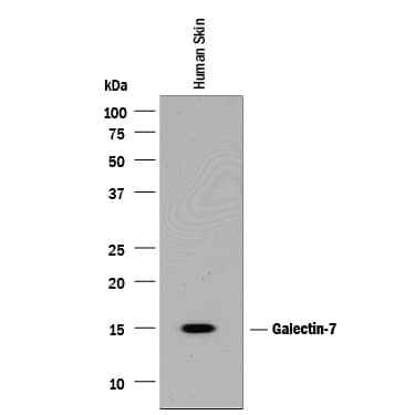 Western Blot Galectin-7 Antibody [Unconjugated]