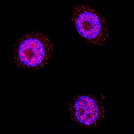 Galectin-7 was detected in immersion fixed HEK001 human skin kerotinocyte cell line using Mouse Anti-Human Galectin-7 Monoclonal Antibody (Catalog # MAB13391) at 5 µg/mL for 3 hours at room temperature. Cells were stained using the NorthernLights™ 557-conjugated Anti-Mouse IgG Secondary Antibody (red; Catalog # NL007) and counterstained with DAPI (blue). Specific staining was localized to cytoplasm and nuclei. View our protocol for Fluorescent ICC Staining of Cells on Coverslips.