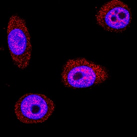 Galectin-7 was detected in immersion fixed HEK001 human epidermal keratinocyte cell line using Mouse Anti-Human Galectin-7 Monoclonal Antibody (Catalog # MAB13392) at 5 µg/mL for 3 hours at room temperature. Cells were stained using the NorthernLights™ 557-conjugated Anti-Mouse IgG Secondary Antibody (red; Catalog # NL007) and counterstained with DAPI (blue). Specific staining was localized to cytoplasm and nuclei. View our protocol for Fluorescent ICC Staining of Cells on Coverslips.