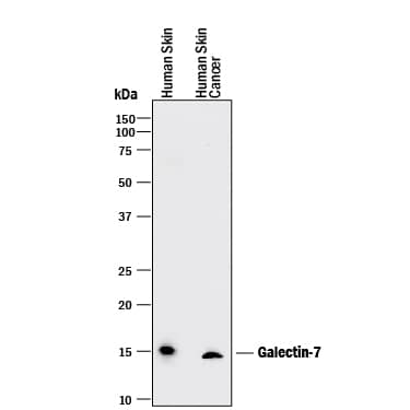 Western blot shows lysates of human skin tissue and human skin cancer tissue. PVDF membrane was probed with 2 µg/mL of Mouse Anti-Human Galectin-7 Monoclonal Antibody (Catalog # MAB13392) followed by HRP-conjugated Anti-Mouse IgG Secondary Antibody (Catalog # HAF018). A specific band was detected for Galectin-7 at approximately 14 kDa (as indicated). This experiment was conducted under reducing conditions and using Immunoblot Buffer Group 1.