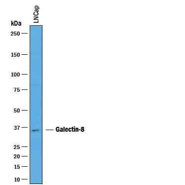 Western Blot Galectin-8 Antibody [Unconjugated]