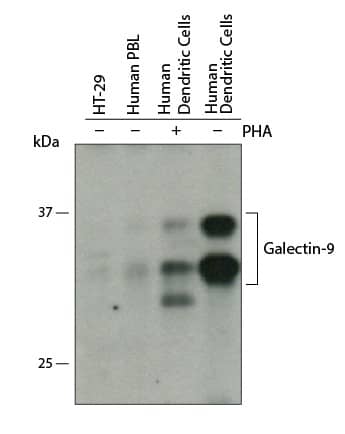 Western Blot Galectin-9 Antibody [Unconjugated]