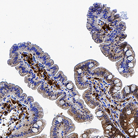 Galectin-9 was detected in immersion fixed paraffin-embedded sections of human colon using Mouse Anti-Human Galectin-9 Monoclonal Antibody (Catalog # MAB20453) at 5 µg/mL for 1 hour at room temperature followed by incubation with the Anti-Mouse IgG VisUCyte™ HRP Polymer Antibody (Catalog # VC001). Before incubation with the primary antibody, tissue was subjected to heat-induced epitope retrieval using Antigen Retrieval Reagent-Basic (Catalog # CTS013). Tissue was stained using DAB (brown) and counterstained with hematoxylin (blue). Specific staining was localized to cytoplasm in villi. View our protocol for IHC Staining with VisUCyte HRP Polymer Detection Reagents.