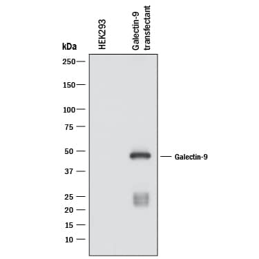 Western blot shows lysates of HEK293 human embryonic kidney cell line either mock transfected or transfected with human Galectin-9 . PVDF membrane was probed with 2 µg/mL of Mouse Anti-Human Galectin-9 Monoclonal Antibody (Catalog # MAB20453) followed by HRP-conjugated Anti-Mouse IgG Secondary Antibody (Catalog # HAF018). A specific band was detected for Galectin-9 at approximately 45 kDa (as indicated). This experiment was conducted under reducing conditions and using Immunoblot Buffer Group 1.