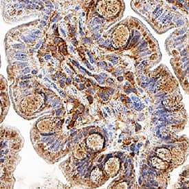 Galectin-9 was detected in immersion fixed paraffin-embedded sections of human colon using Mouse Anti-Human Galectin-9 Monoclonal Antibody (Catalog # MAB20454) at 5 µg/mL for 1 hour at room temperature followed by incubation with the Anti-Mouse IgG VisUCyte™ HRP Polymer Antibody (Catalog # VC001). Before incubation with the primary antibody, tissue was subjected to heat-induced epitope retrieval using Antigen Retrieval Reagent-Basic (Catalog # CTS013). Tissue was stained using DAB (brown) and counterstained with hematoxylin (blue). Specific staining was localized to cytoplasm in villi. View our protocol for IHC Staining with VisUCyte HRP Polymer Detection Reagents.