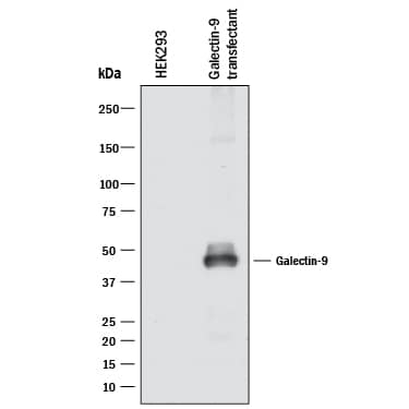 Western blot shows lysates of HEK293 human embryonic kidney cell line either mock transfected or transfected with human Galectin-9 . PVDF membrane was probed with 2 µg/mL of Mouse Anti-Human Galectin-9 Monoclonal Antibody (Catalog # MAB20454) followed by HRP-conjugated Anti-Mouse IgG Secondary Antibody (Catalog # HAF018). A specific band was detected for Galectin-9 at approximately 45 kDa (as indicated). This experiment was conducted under reducing conditions and using Immunoblot Buffer Group 1.