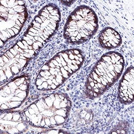 Galectin-9 was detected in immersion fixed paraffin-embedded sections of human colon using Mouse Anti-Human Galectin-9 Monoclonal Antibody (Catalog # MAB20455) at 0.5 µg/mL for 1 hour at room temperature followed by incubation with the Anti-Mouse IgG VisUCyte™ HRP Polymer Antibody (Catalog # VC001). Before incubation with the primary antibody, tissue was subjected to heat-induced epitope retrieval using Antigen Retrieval Reagent-Basic (Catalog # CTS013). Tissue was stained using DAB (brown) and counterstained with hematoxylin (blue). Specific staining was localized to bile canaliculi. View our protocol for IHC Staining with VisUCyte HRP Polymer Detection Reagents.