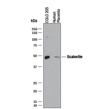 Western blot shows lysates of COLO 205 human colorectal adenocarcinoma cell line and human placenta tissue. PVDF membrane was probed with 2 µg/mL of Mouse Anti-Human Galectin-9 Monoclonal Antibody (Catalog # MAB20456) followed by HRP-conjugated Anti-Mouse IgG Secondary Antibody (Catalog # HAF018). A specific band was detected for Galectin-9 at approximately 50 kDa (as indicated). This experiment was conducted under reducing conditions and using Immunoblot Buffer Group 1.