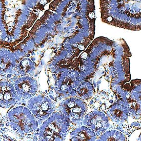 Gas6 was detected in perfusion fixed paraffin-embedded sections of mouse intestine using Goat Anti-Mouse Gas6 Antigen Affinity-purified Polyclonal Antibody (Catalog # AF986) at 1 µg/mL for 1 hour at room temperature followed by incubation with the Anti-Goat IgG VisUCyte™ HRP Polymer Antibody (Catalog # VC004). Before incubation with the primary antibody, tissue was subjected to heat-induced epitope retrieval using Antigen Retrieval Reagent-Basic (Catalog # CTS013). Tissue was stained using DAB (brown) and counterstained with hematoxylin (blue). Specific staining was localized to apical plasma membrane. View our protocol for IHC Staining with VisUCyte HRP Polymer Detection Reagents.