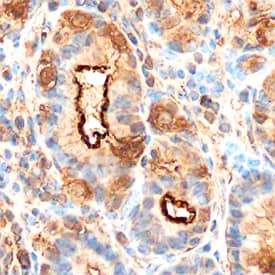 Gastrokine 1 was detected in immersion fixed paraffin-embedded sections of human stomach using Sheep Anti-Human Gastrokine 1 Antigen Affinity-purified Polyclonal Antibody (Catalog # AF6395) at 3 µg/mL overnight at 4 °C. Before incubation with the primary antibody, tissue was subjected to heat-induced epitope retrieval using Antigen Retrieval Reagent-Basic (CTS013). Tissue was stained using the Anti-Sheep HRP-DAB Cell & Tissue Staining Kit (brown; CTS019) and counterstained with hematoxylin (blue). Specific staining was localized to luminal part of glandular epithelial cells. View our protocol for Chromogenic IHC Staining of Paraffin-embedded Tissue Sections.
