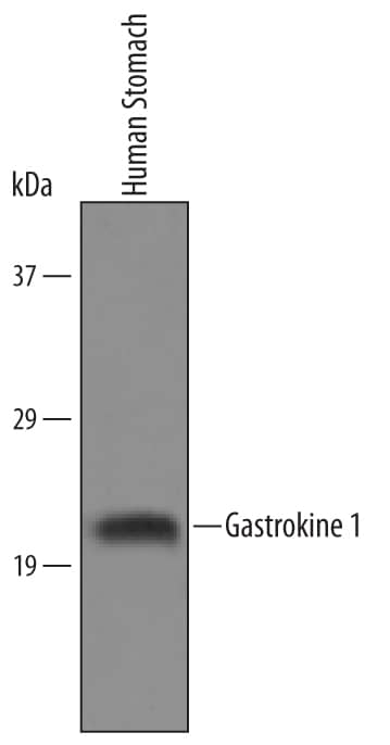Western blot shows lysates of human stomach tissue. PVDF Membrane was probed with 1 µg/mL of Human Gastrokine 1 Antigen Affinity-purified Polyclonal Antibody (Catalog # AF6395) followed by HRP-conjugated Anti-Sheep IgG Secondary Antibody (HAF016). A specific band was detected for Gastrokine 1 at approximately 20 kDa (as indicated). This experiment was conducted under reducing conditions and using Immunoblot Buffer Group 8.