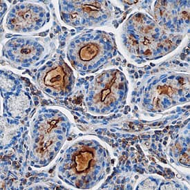 Immunohistochemistry Gastrokine 1 Antibody