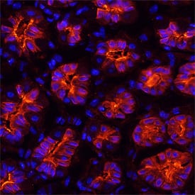 Immunohistochemistry Gastrokine 1 Antibody