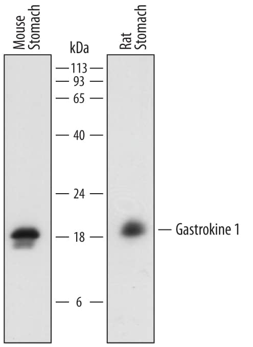 Western Blot Gastrokine 1 Antibody
